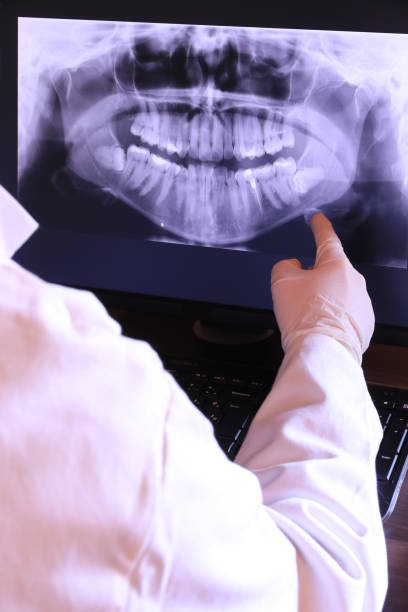 Best Broken or Chipped Tooth Repair in Steele, AL