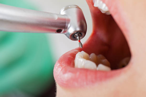 Best Emergency Dental Care for Sports Injuries in Steele, AL